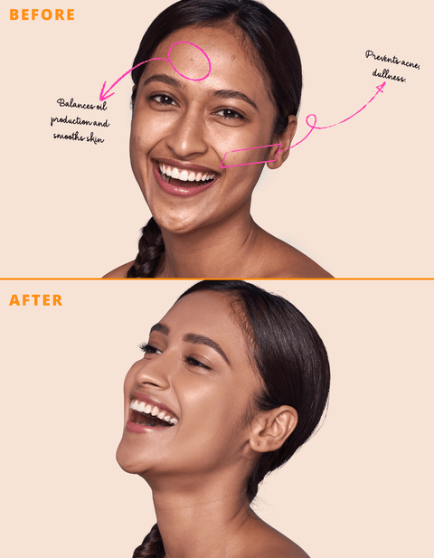 matte up foundation for acne prone skin