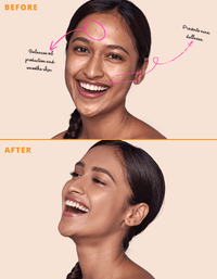matte up foundation for acne prone skin